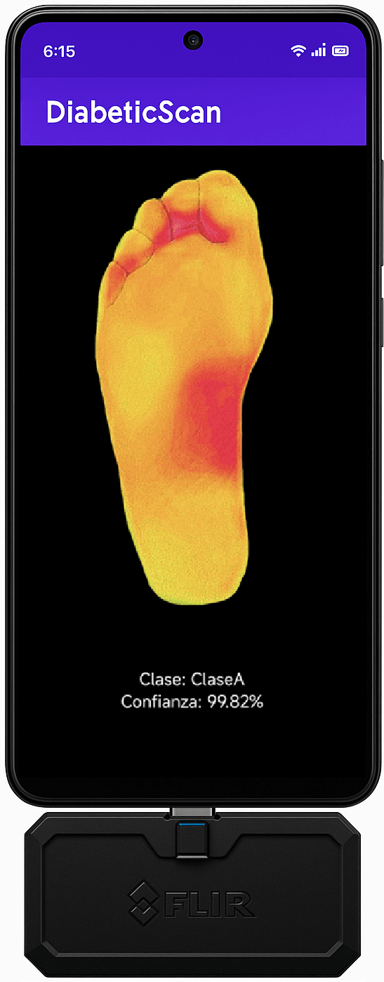 Prototipo funcional de DiabeticScan